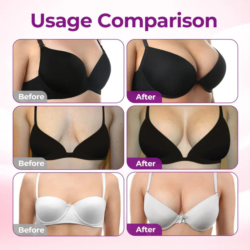 👩⚕️Turonu® ✨✨Targeted Breast Enhancement Advanced Nano Microneedle Patch✨