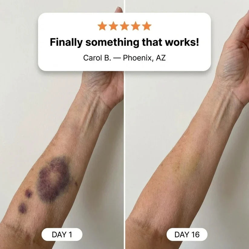 LOVEHERWM® Bruise Repair & Skin-Strengthening Cream